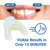Medidenta - Whiter Image - 9% HP - Prefilled Teeth Whitening Tray Kit - 03