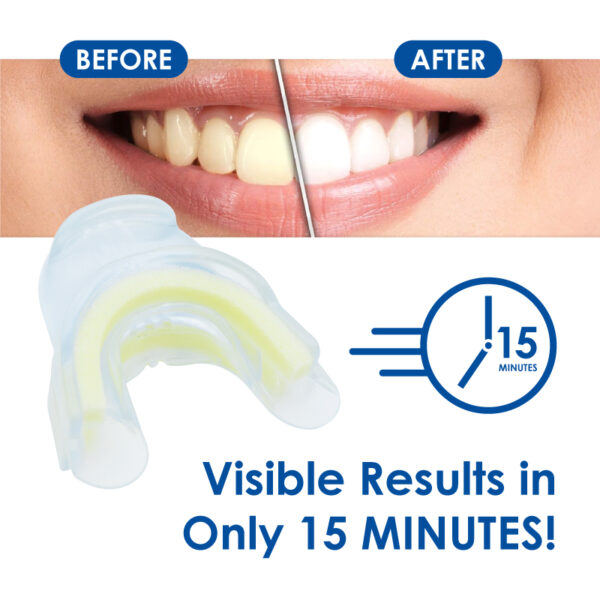 Medidenta - Whiter Image - 9% HP - Prefilled Teeth Whitening Tray Kit - 03