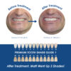 Medidenta - Whiter Image - 9% HP - Prefilled Teeth Whitening Tray Kit - 07