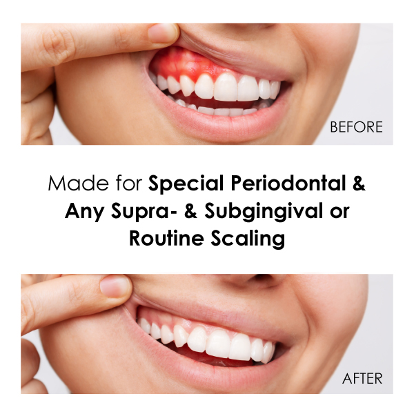 Medidenta - Handpieces - Hygiene Handpieces - Medi-Scaler Ultrasonic Scaler Updated December 2025 04