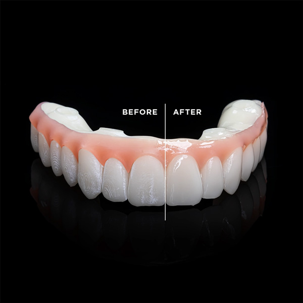 DIG Medidenta - 3D Printing - Resins - Rodin® Glaze N2-Free - Gallery 02