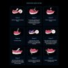 DIG Medidenta - 3D Printing - Resins - Rodin® Soft Reline Kit - Gallery 03