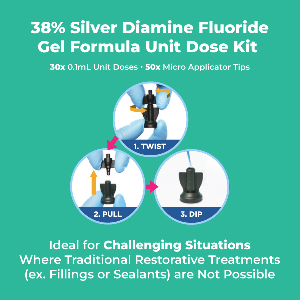 DIG Medidenta - SDF Pro™ 38% Silver Diamine Fluoride Solution Unit Dose Kit - Gallery 01